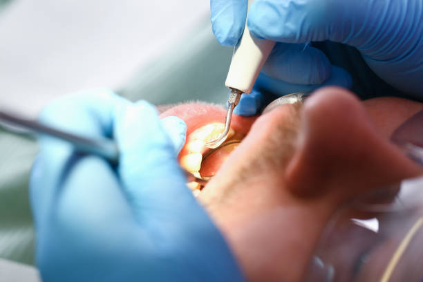 Best Emergency Dental Care for Abscessed Tooth in New Market, AL